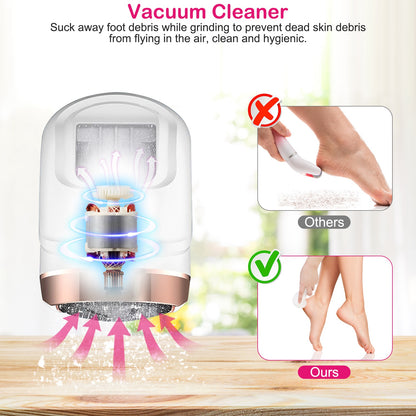 Product dimensions — Zelbea electric callus remover