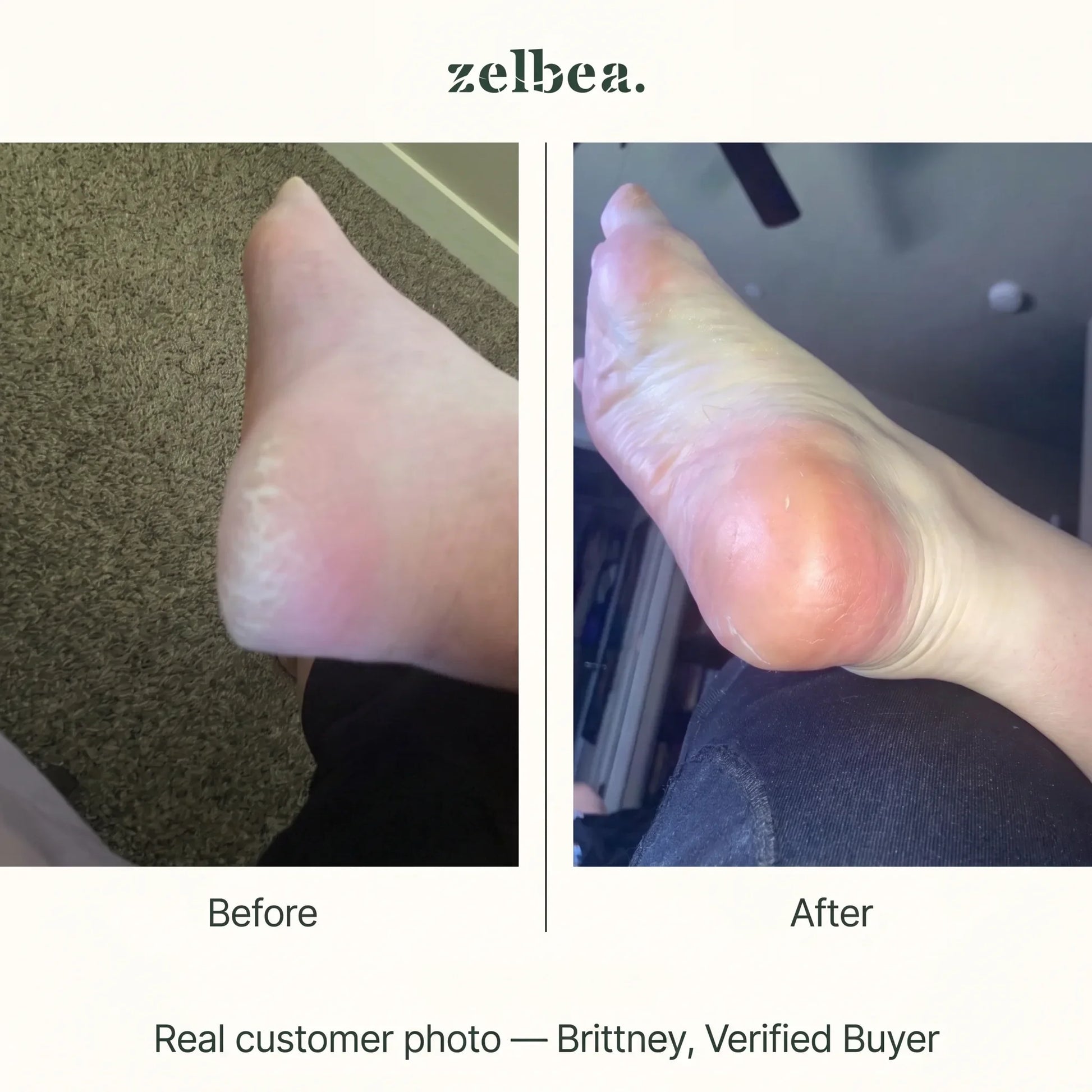 Real customer before and after photo — Brittney, verified buyer