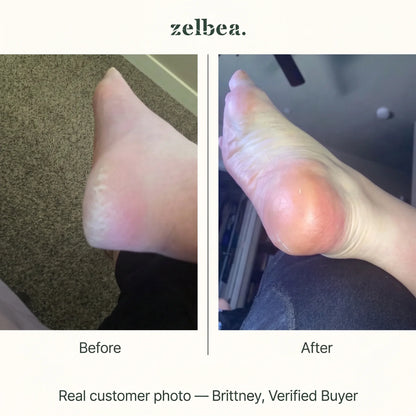 Real customer before and after photo — Brittney, verified buyer